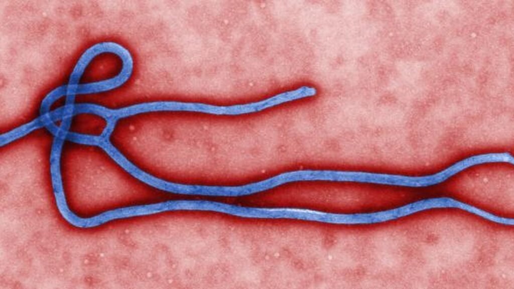 Digitally-colorized, transmission electron microscopic image which demonstrates the filamentous, branching structure of an Ebola virus particle. See PHIL 1832 for a black and white version of this image.